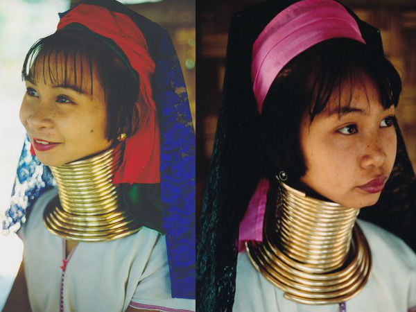 गर्दन लंबी हो जाती है 