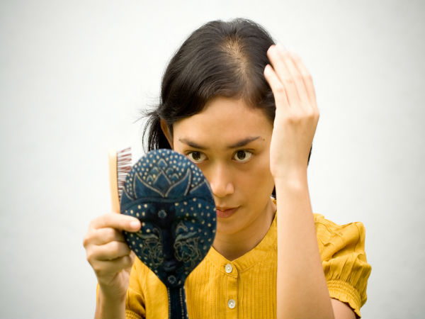 What is female pattern baldness? Reasons and how to treat it?