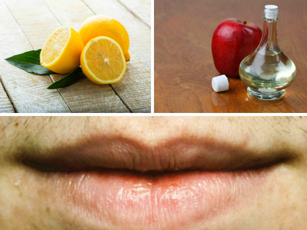 Effective Home Remedies To Cure White Spots On Lips Effective Home Remedies To Cure White Spots On Lips