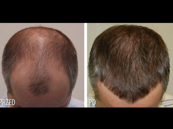 9. सुन्‍न हो जाना