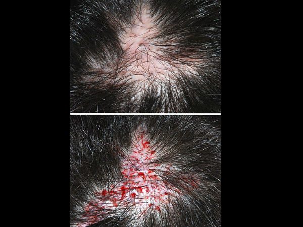 7. रक्त स्राव