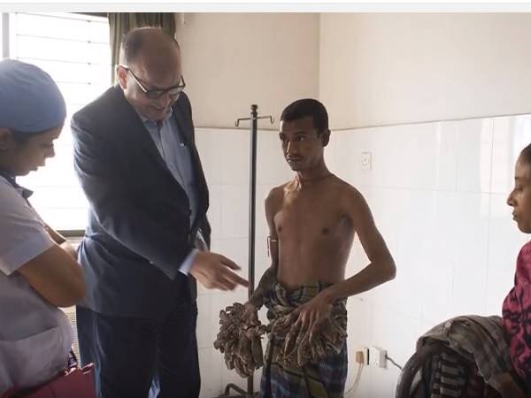 क्‍या कहा डॉक्‍टरों ने 