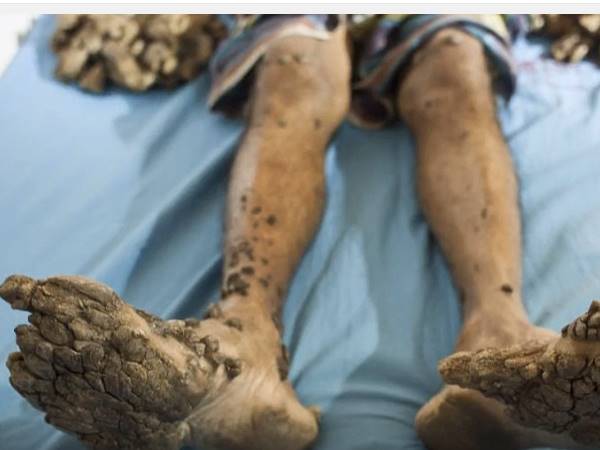 काफी होती है दिक्‍कत 