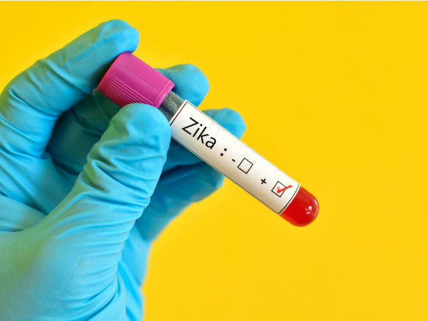 Zika virus infection through intercource reported in US