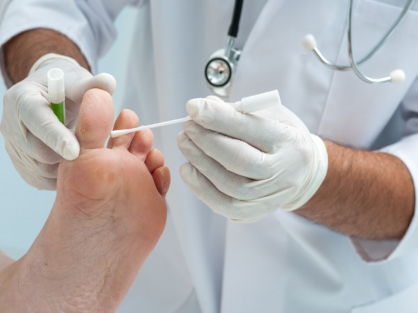  चरण 1: घावों को साफ करना