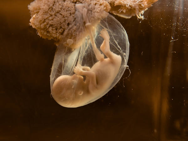 surprising things babies do in the womb2