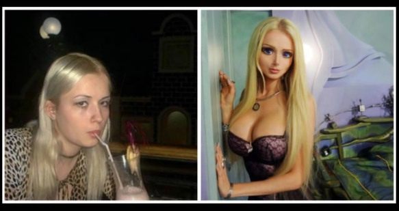 प्‍लास्‍टिक सर्जरी के पहले