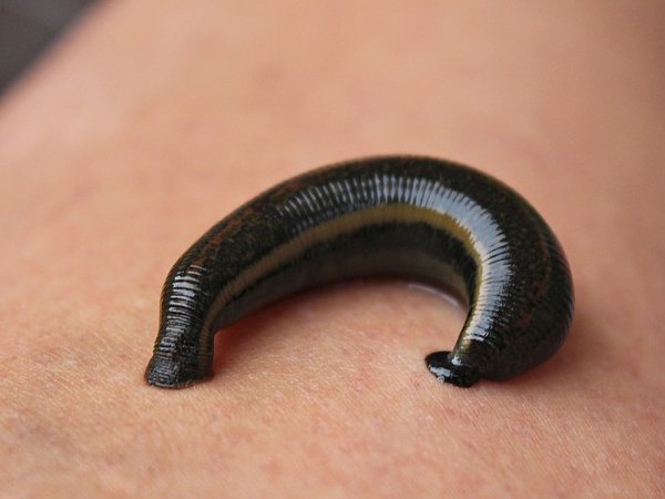 How Is Leech Therapy Beneficial? How Is Leech Therapy Beneficial?
