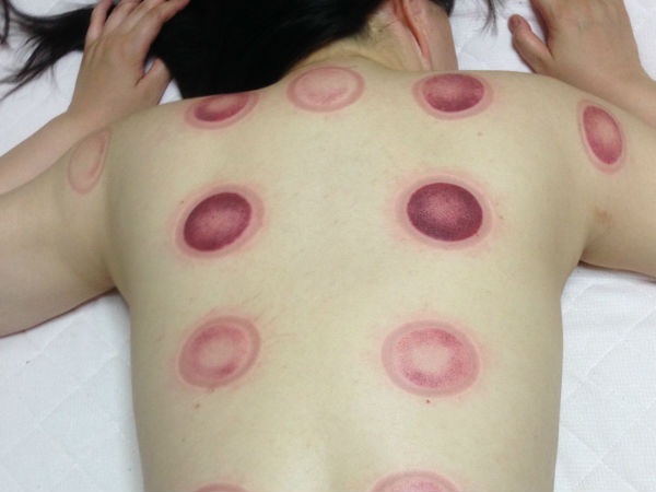  6. त्वचा की स्थिति में सुधार 