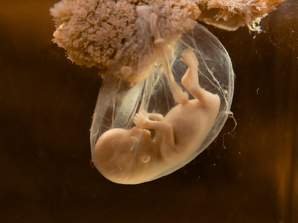  बच्चे का हार्ट – 