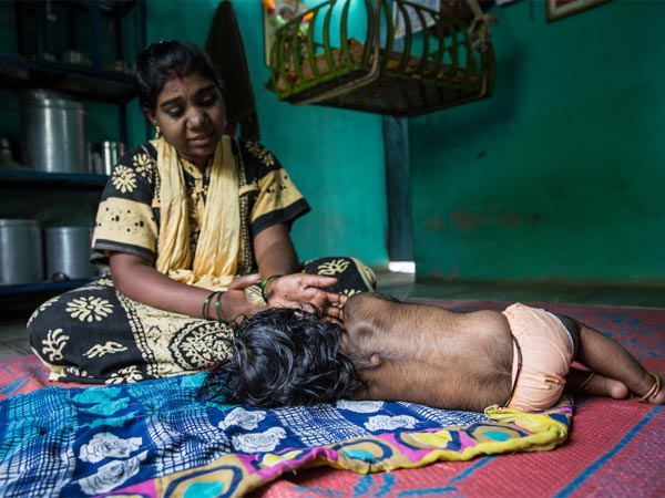 बेबी को मिला अपनी मां से ये जीन