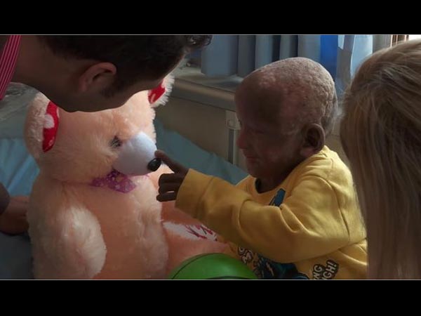  अब उसकी हालत में हो रहा है सुधार 