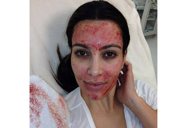 2000 यूरो तक का खर्च 