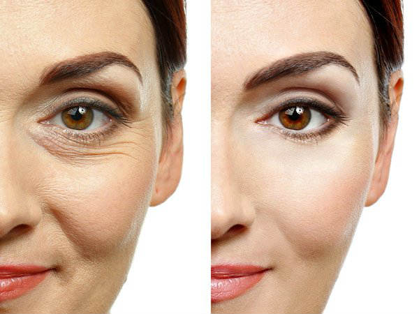 प्रकिया से पहले ध्यान में रखने वाली बातें