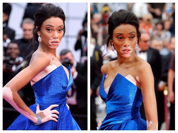  विनी हार्लो 