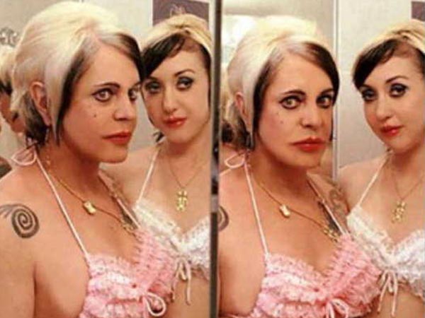 गर्लफ्रेंड की तरह दिखने के लिए प्लास्टिक सर्जरी करवाई 