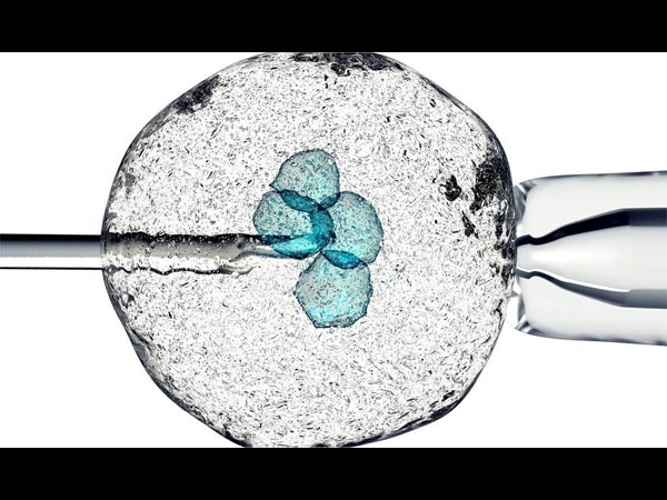 अमेरिका और इजरायल 