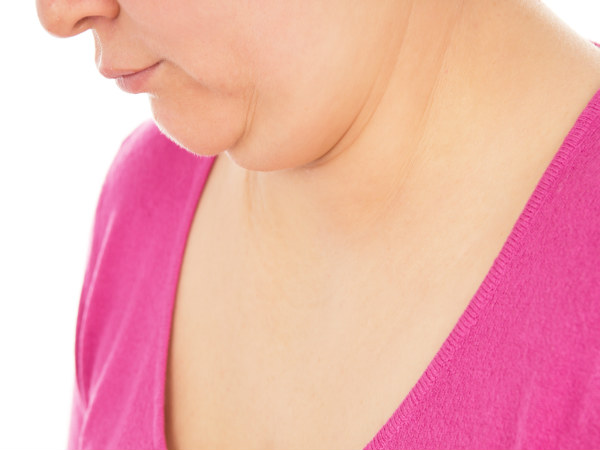 underactive thyroid double chin