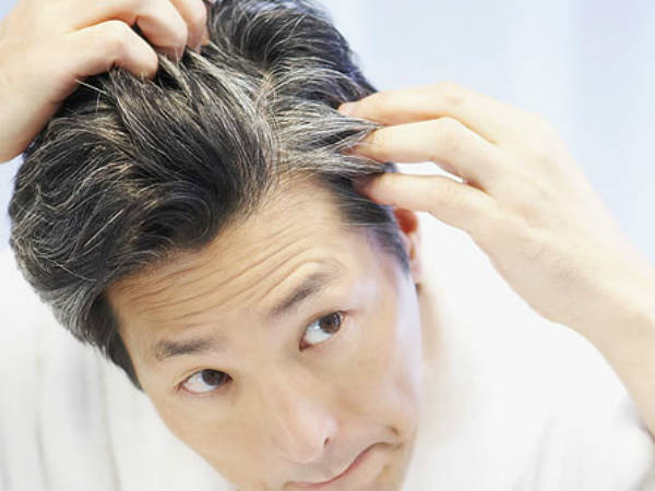 5 Foods That Cause Gray Hair 5 Foods That Cause Gray Hair