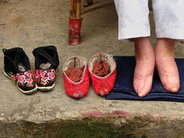 अजीब मानसिकता की वजह से अस्तित्‍व में आई 