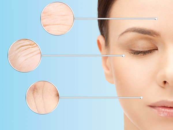 झुर्रियां कम करे