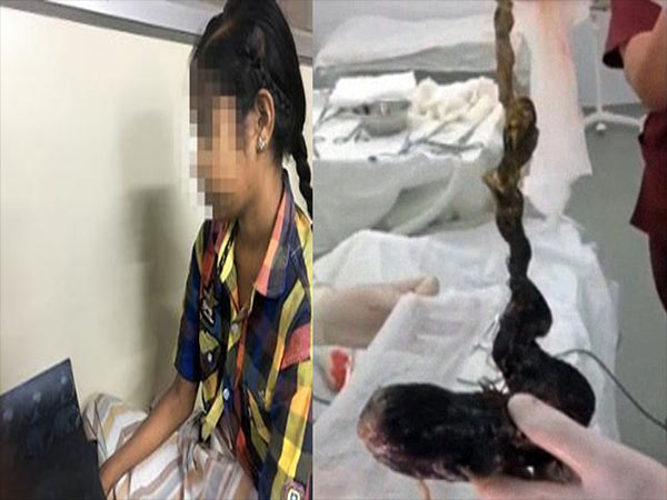 बाल खाती थी ये लड़की