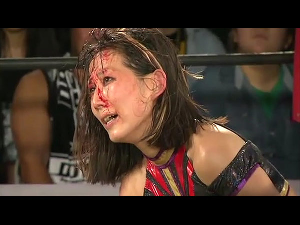 ब्लड इंजरी