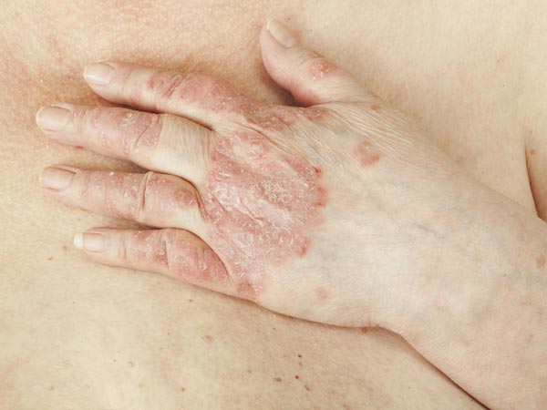  1) त्वचा संबंधी परेशानियों के लिए 