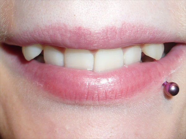 कुछ बच्चे मुंह से सांस लेते है