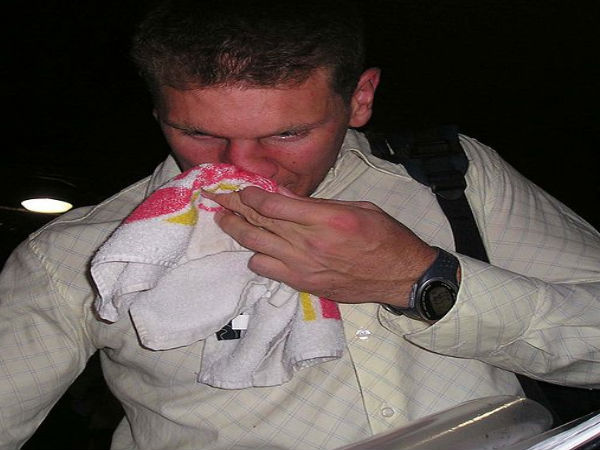 नकसीर फूटना