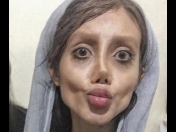 50 surgeries to look like Angelina Jolie