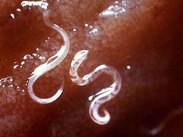  2 साल में 22 लीटर खून पी गए 