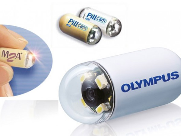  कैप्सूल एंडोस्कोपी ने प‍कड़ में आया मामला 