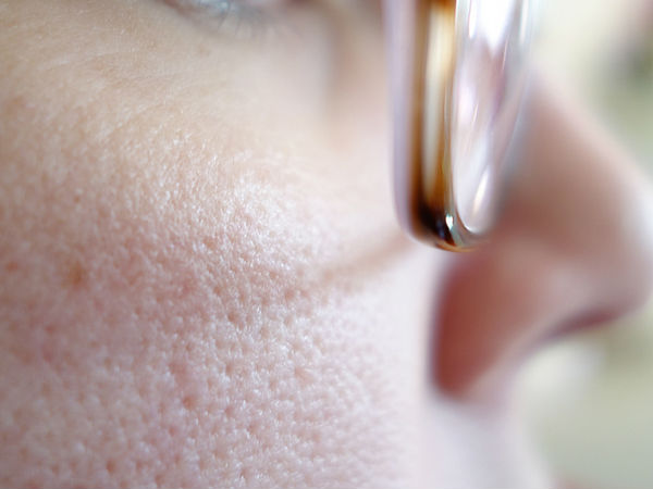 open pores open pores