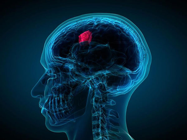 ब्रेन के अलावा रीढ़ की हड्डी में भी 