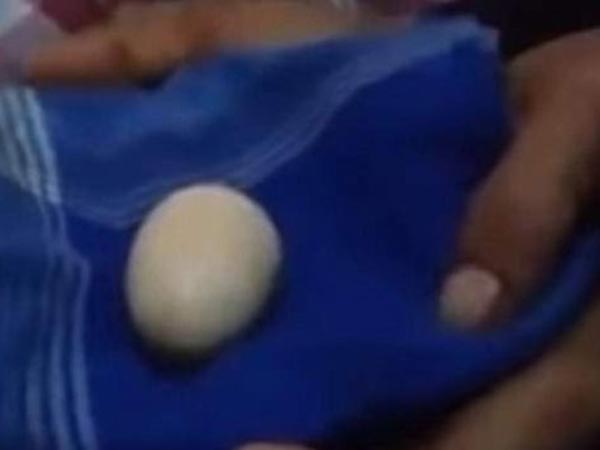 डॉक्टर्स भी हुए हक्‍के बक्‍के...