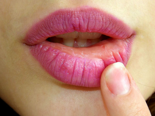 4- ड्राई स्किन के लिए सेब का इस्तेमाल: