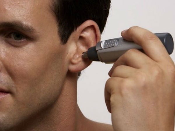 लेज़र हेयर रिमूवल- 