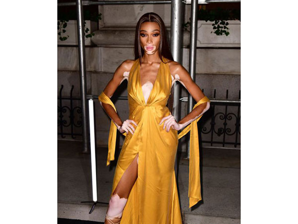  अमेरिकाज नेक्‍स्‍ट टॉप मॉडल में भी आ चुकी है नजर 