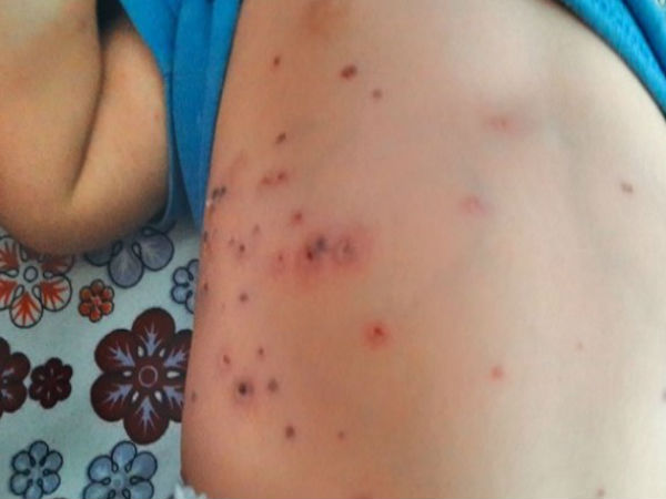 मल्टी-ऑर्गन डिसऑर्डर भी 