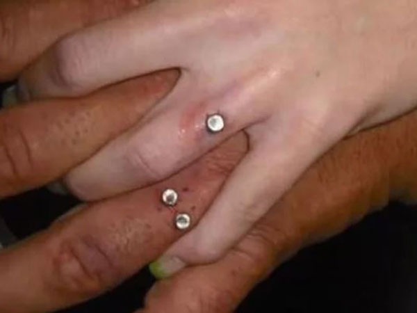 ये जीवनभर के लिए है एक जख्म 