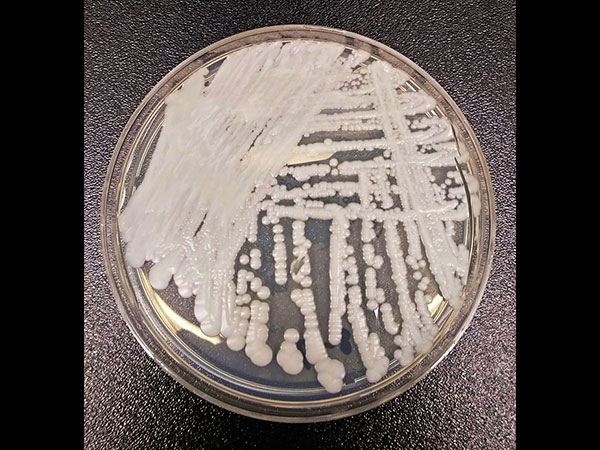 30 से 90 दिनों में हो सकती है मौत 