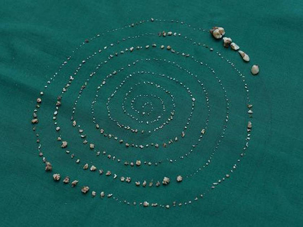  3 साल की उम्र से थी बच्‍चे को तकलीफ