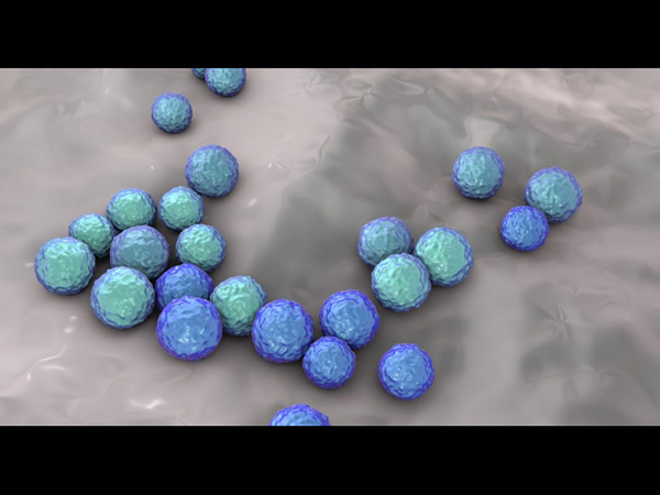 अस्‍पताल की वजह से होता है ये संक्रमण 