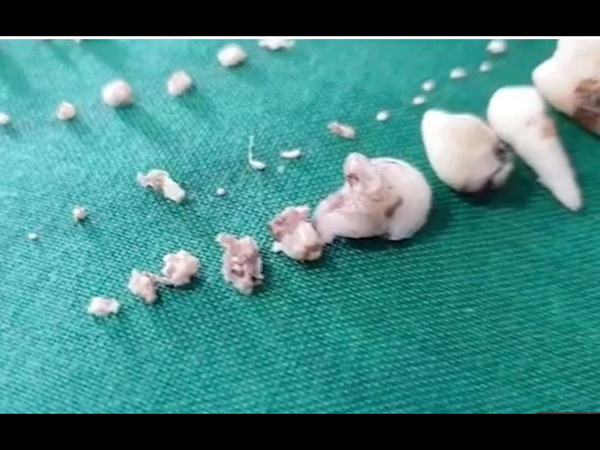 पहले भी आ चुके है ऐसे मामले 