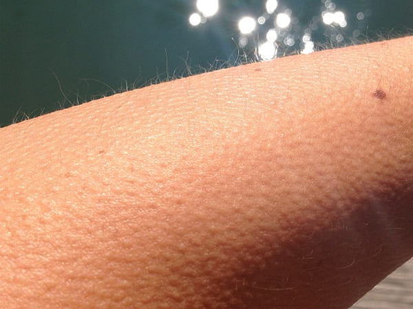  रोंगटे खड़े होने के साथ क्‍या होता है?