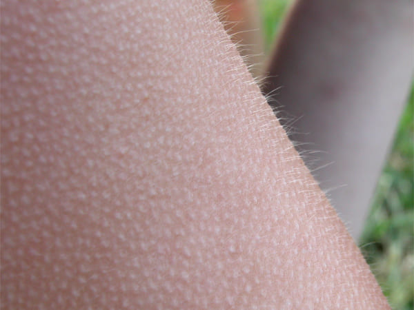 रोंगटे खड़े होने का वैज्ञानिक कारण