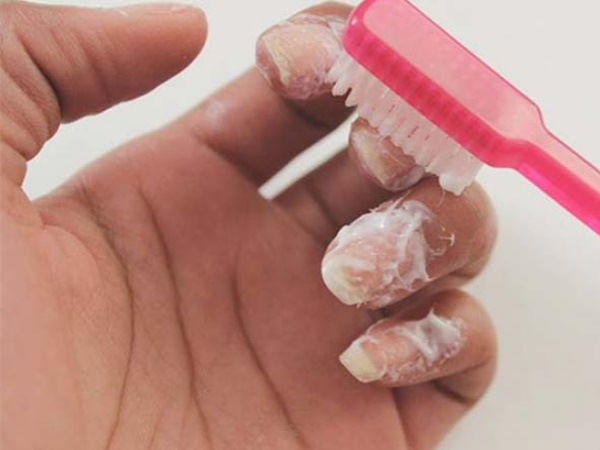 टूथपेस्ट