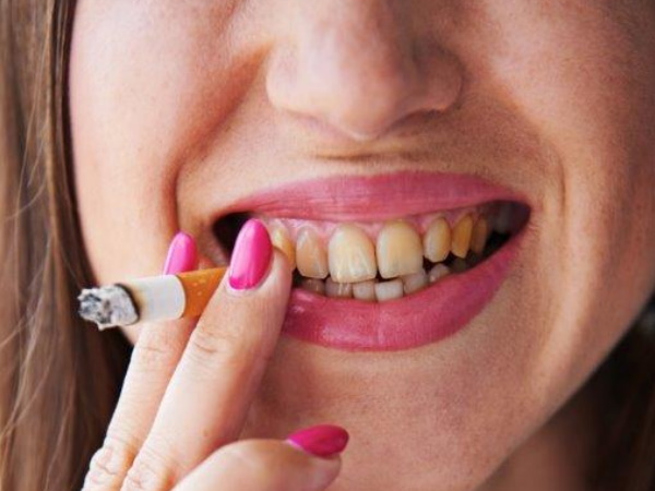 पीले दांत