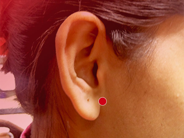  कान के पीछे